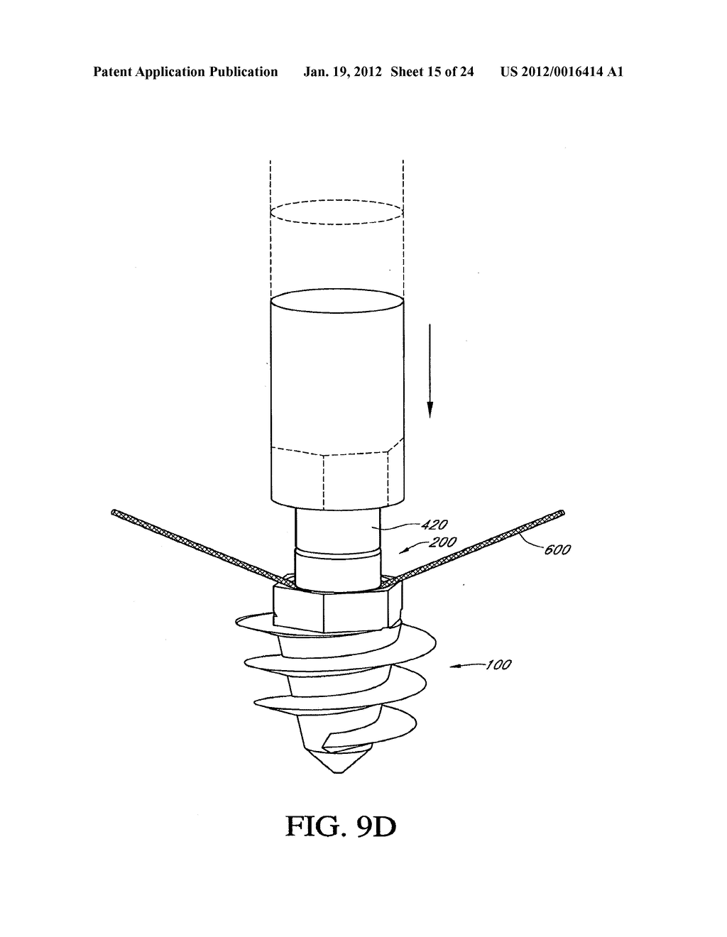 SYSTEM AND METHOD FOR ATTACHING SOFT TISSUE TO BONE - diagram, schematic, and image 16