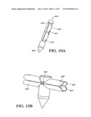 SYSTEM AND METHOD FOR ATTACHING SOFT TISSUE TO BONE diagram and image