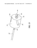 SYSTEM AND METHOD FOR ATTACHING SOFT TISSUE TO BONE diagram and image