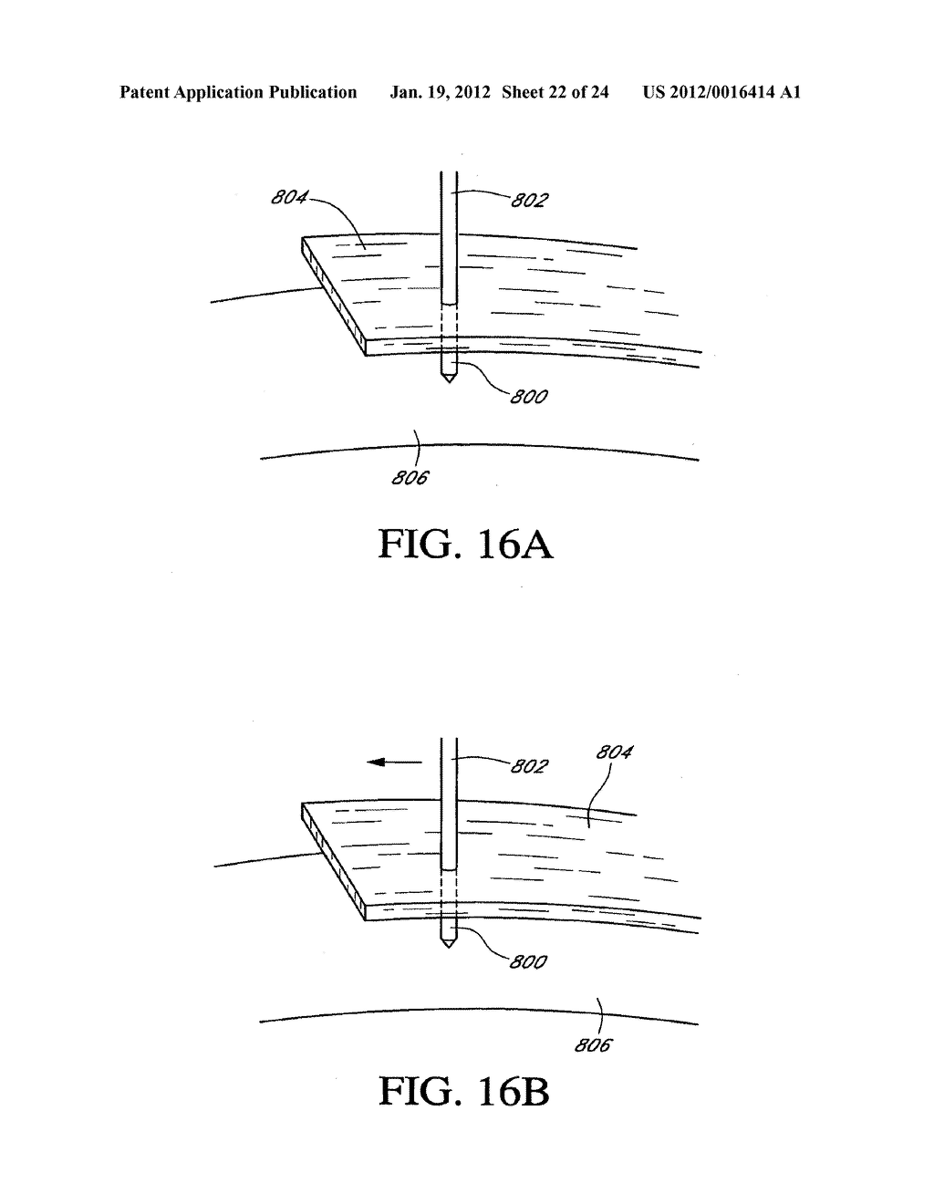 SYSTEM AND METHOD FOR ATTACHING SOFT TISSUE TO BONE - diagram, schematic, and image 23