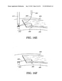 SYSTEM AND METHOD FOR ATTACHING SOFT TISSUE TO BONE diagram and image