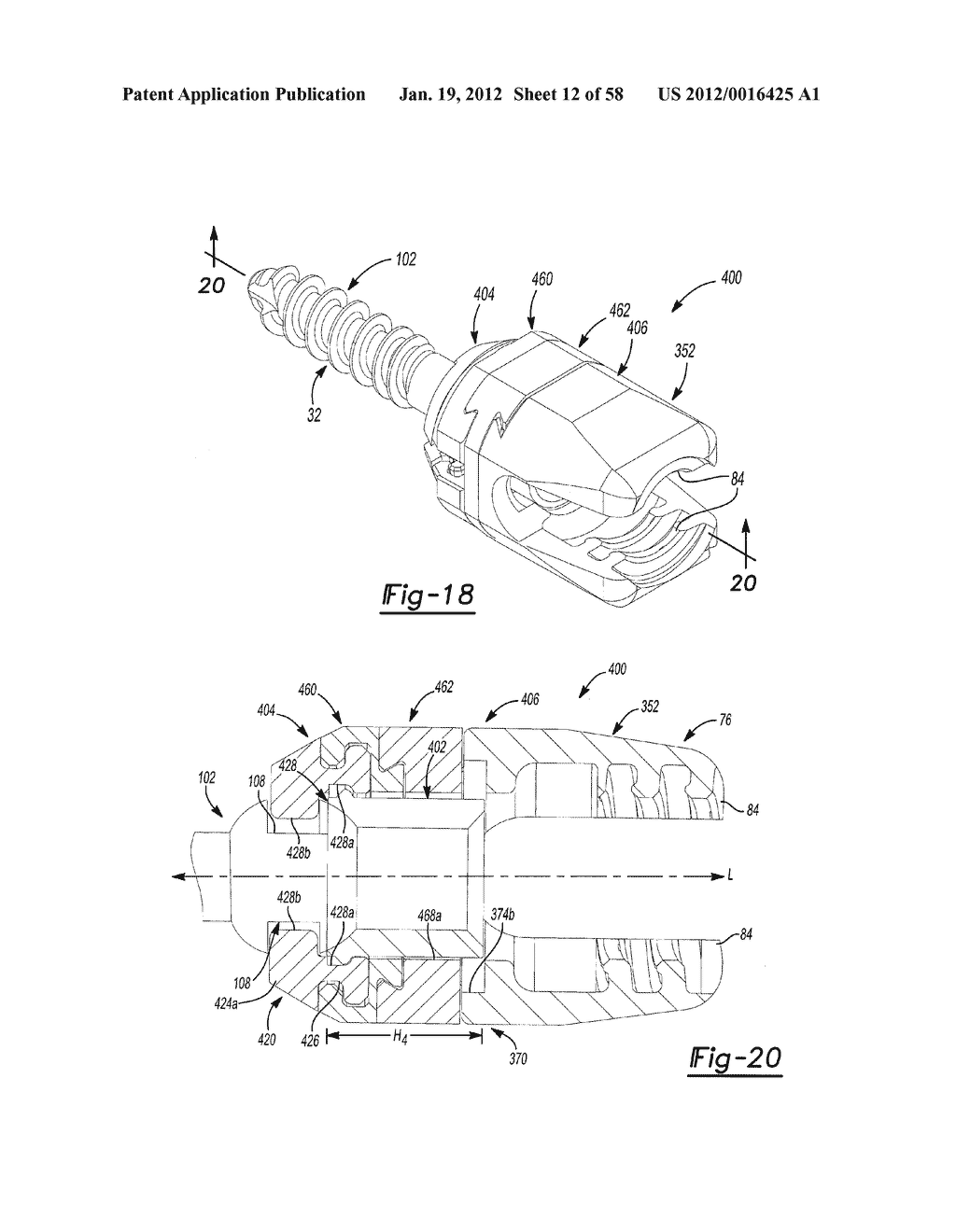 MULTIPLANAR BONE ANCHOR SYSTEM - diagram, schematic, and image 13