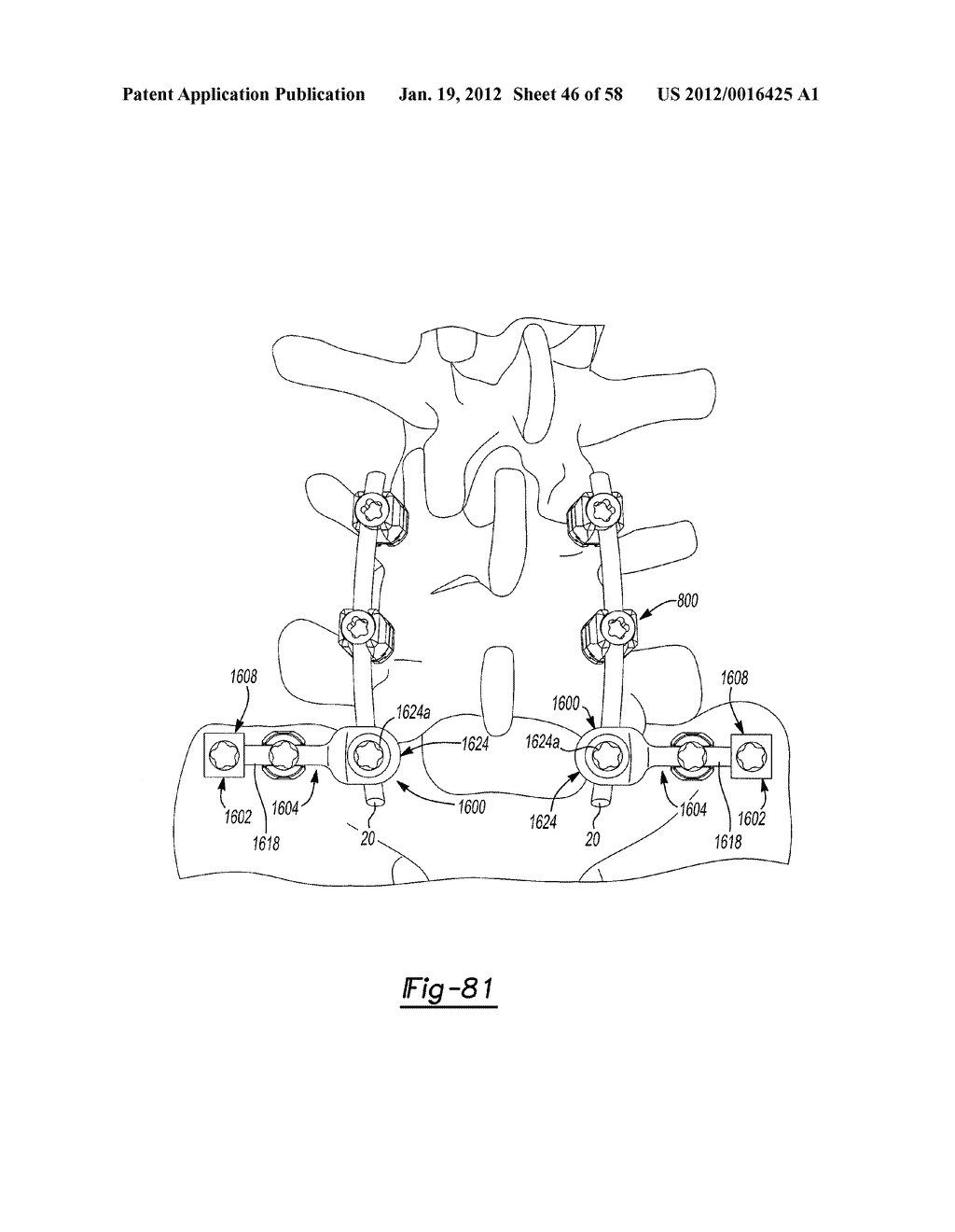 MULTIPLANAR BONE ANCHOR SYSTEM - diagram, schematic, and image 47