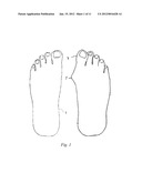 BUNION CORRECTION METHOD AND DEVICE diagram and image