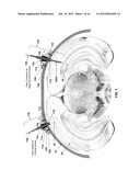 Implantable Connector Systems Having Magnetic Portions Thereon and Related     Methods diagram and image