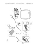 VESTIBULAR STIMULATION SYSTEM diagram and image