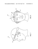 VESTIBULAR STIMULATION SYSTEM diagram and image