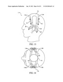 VESTIBULAR STIMULATION SYSTEM diagram and image