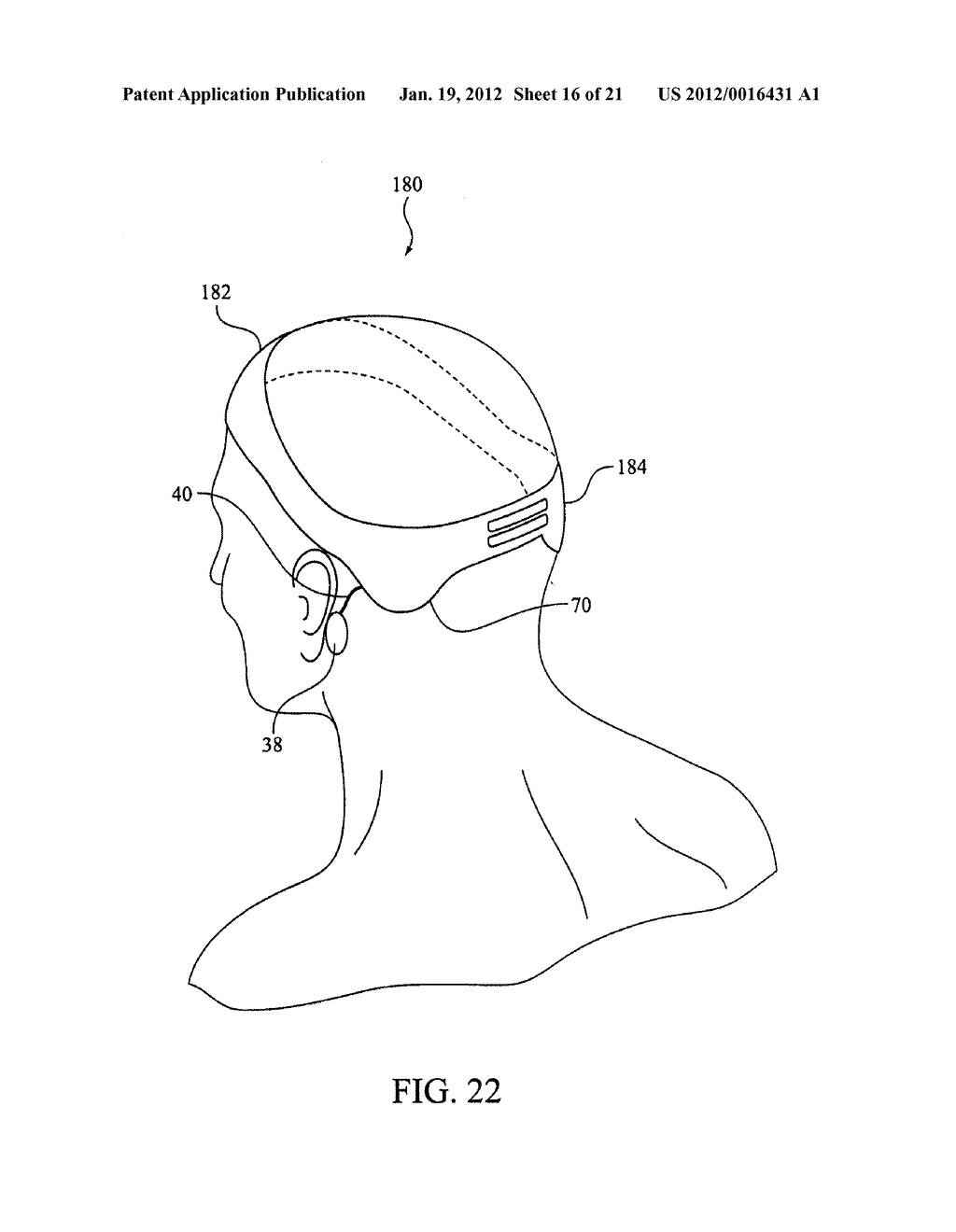 VESTIBULAR STIMULATION SYSTEM - diagram, schematic, and image 17