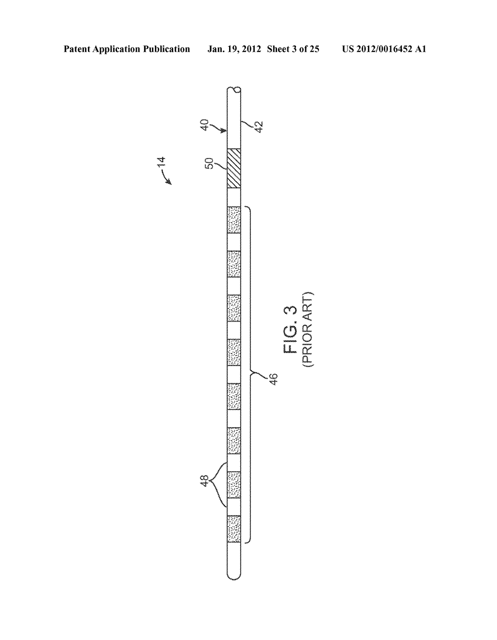 HIGH-RESOLUTION CONNECTOR FOR A NEUROSTIMULATION LEAD - diagram, schematic, and image 04