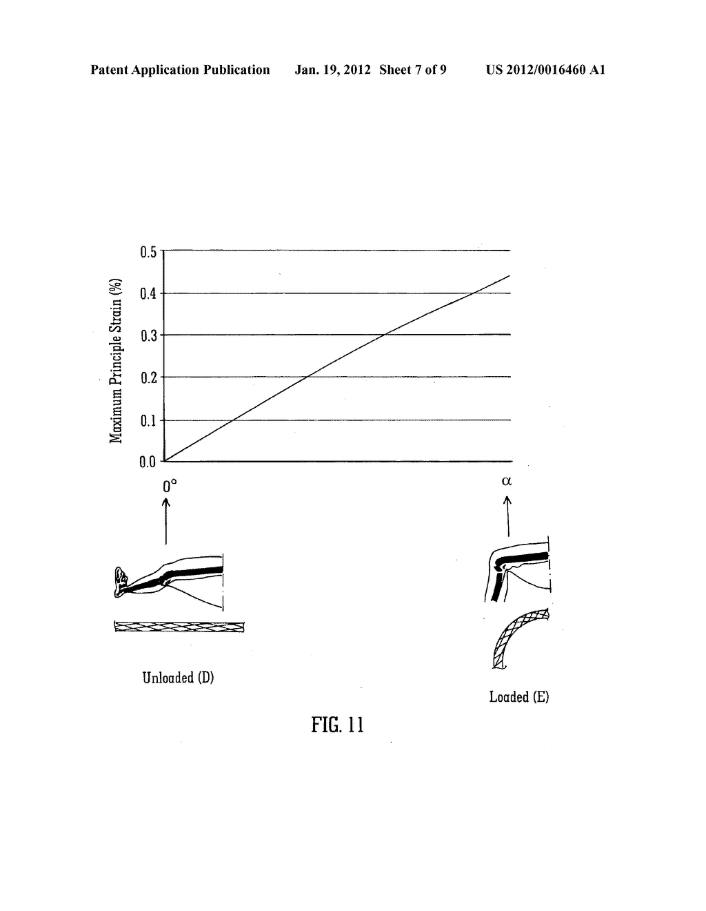  MEDICAL DEVICE SUITABLE FOR LOCATION IN A BODY LUMEN - diagram, schematic, and image 08