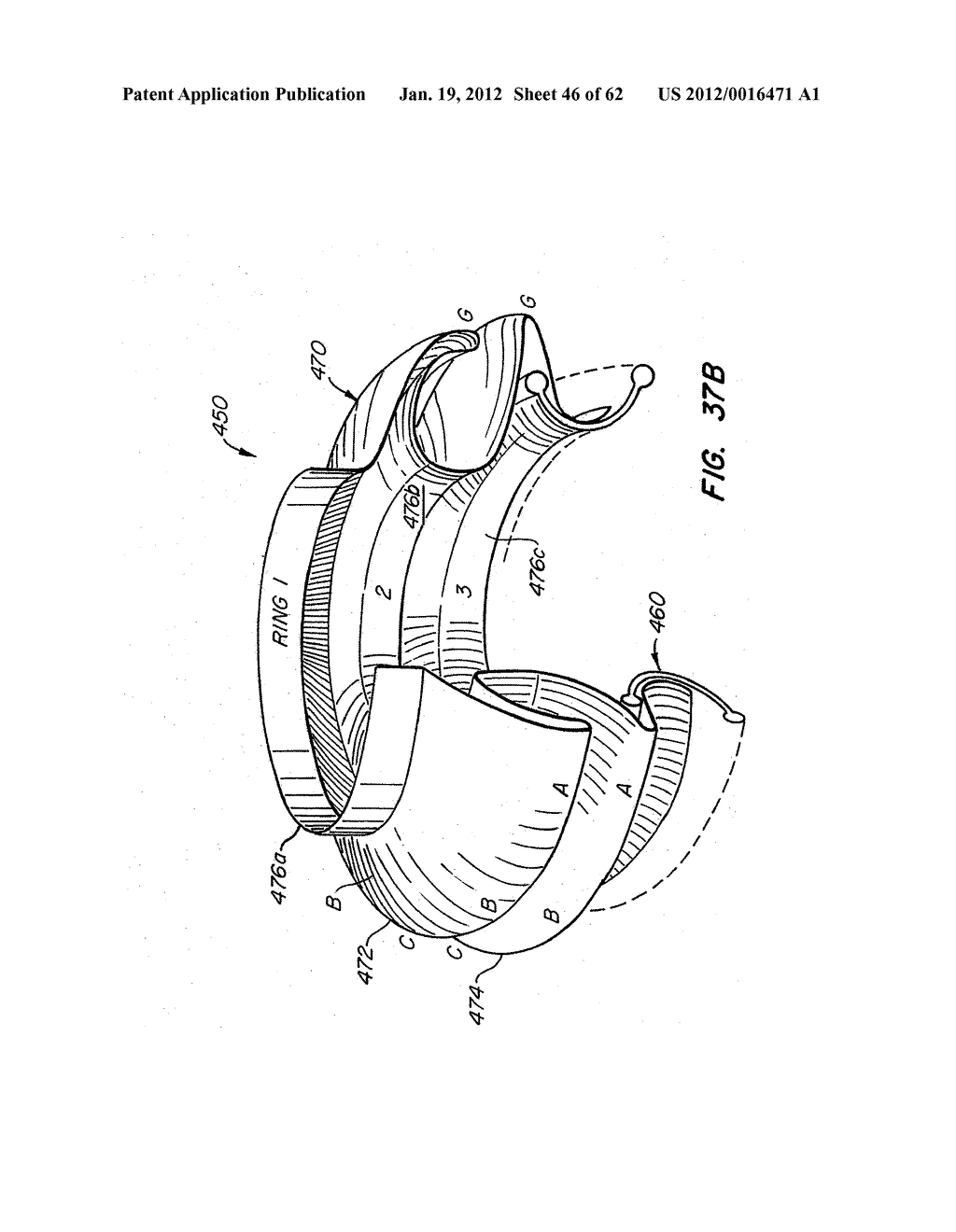 Low Profile Heart Valve and Delivery System - diagram, schematic, and image 47