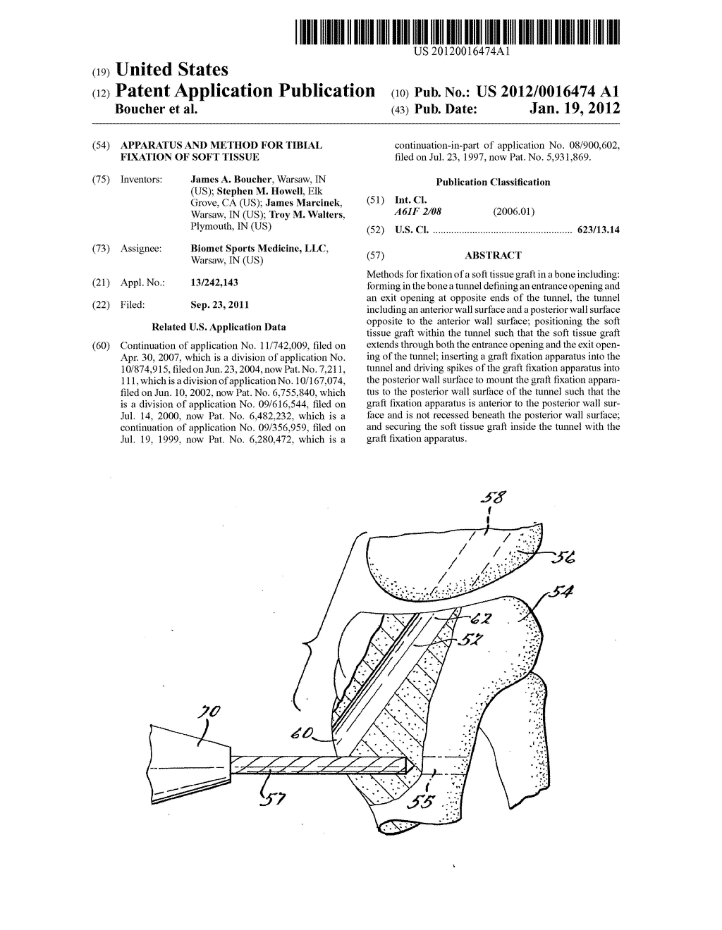 Apparatus and Method for Tibial Fixation of Soft Tissue - diagram, schematic, and image 01