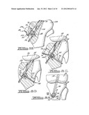 Apparatus and Method for Tibial Fixation of Soft Tissue diagram and image