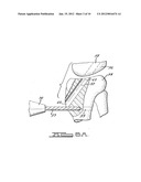 Apparatus and Method for Tibial Fixation of Soft Tissue diagram and image