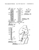 Apparatus and Method for Tibial Fixation of Soft Tissue diagram and image