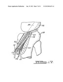 Apparatus and Method for Tibial Fixation of Soft Tissue diagram and image