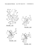 Apparatus and Method for Tibial Fixation of Soft Tissue diagram and image