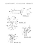 Apparatus and Method for Tibial Fixation of Soft Tissue diagram and image