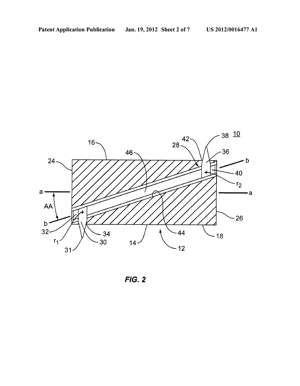 LOCKABLE IMPLANT AND METHOD OF USE - diagram, schematic, and image 03