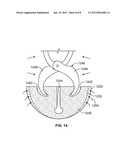 IMPLANT COMPONENTS AND METHODS diagram and image