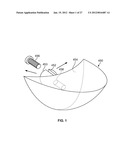 IMPLANT COMPONENTS AND METHODS diagram and image