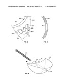 IMPLANT COMPONENTS AND METHODS diagram and image