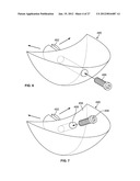 IMPLANT COMPONENTS AND METHODS diagram and image