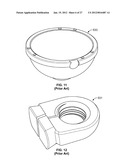 IMPLANT COMPONENTS AND METHODS diagram and image