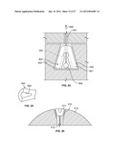 IMPLANT COMPONENTS AND METHODS diagram and image