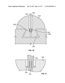 IMPLANT COMPONENTS AND METHODS diagram and image