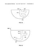 IMPLANT COMPONENTS AND METHODS diagram and image