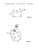 IMPLANT COMPONENTS AND METHODS diagram and image