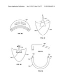 IMPLANT COMPONENTS AND METHODS diagram and image