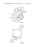 IMPLANT COMPONENTS AND METHODS diagram and image