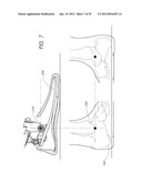 TRANSFEMORAL PROSTHETIC SYSTEMS AND METHODS FOR OPERATING THE SAME diagram and image