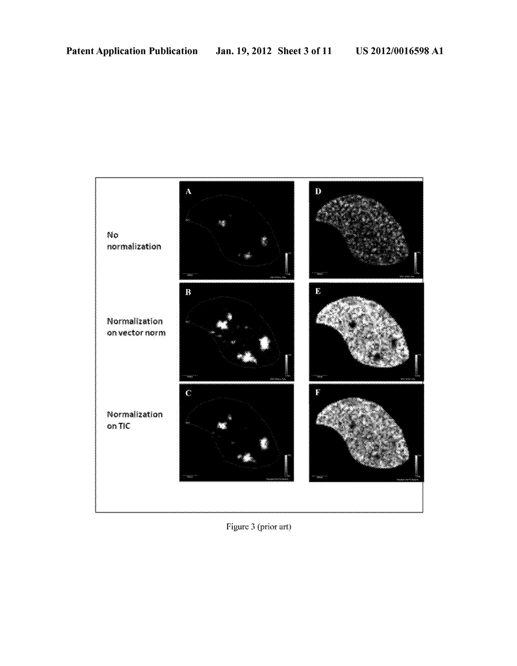 NORMALIZATION OF MASS SPECTRA ACQUIRED BY MASS SPECTROMETRIC IMAGING - diagram, schematic, and image 04