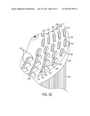 SHAPE MEMORY ALLOY POWERED HYDRAULIC ACCUMULATOR HAVING ACTUATION PLATES diagram and image