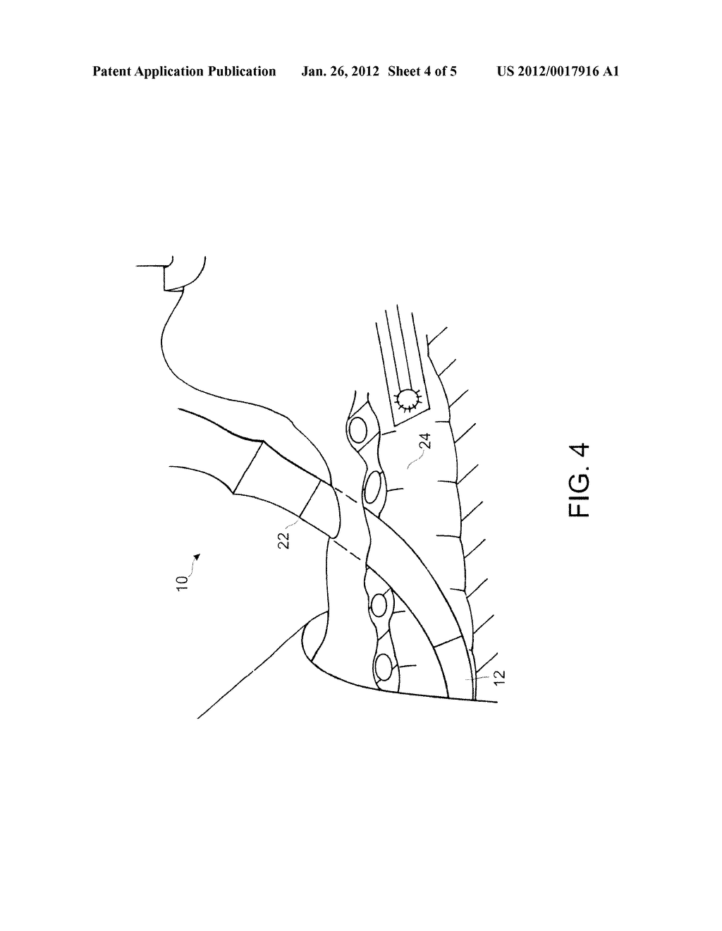 Dilator With Integrated Guiding Catheter - diagram, schematic, and image 05