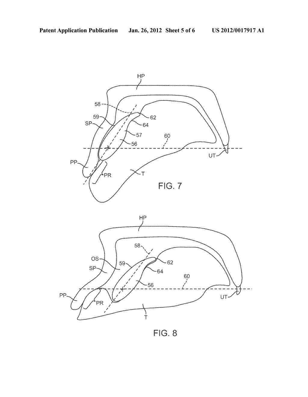 AIRWAY DEVICE WITH TONGUE-ENGAGING MEMBER - diagram, schematic, and image 06