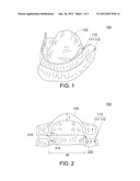 Oral Fixation Device and Fixing Method Using the Same diagram and image