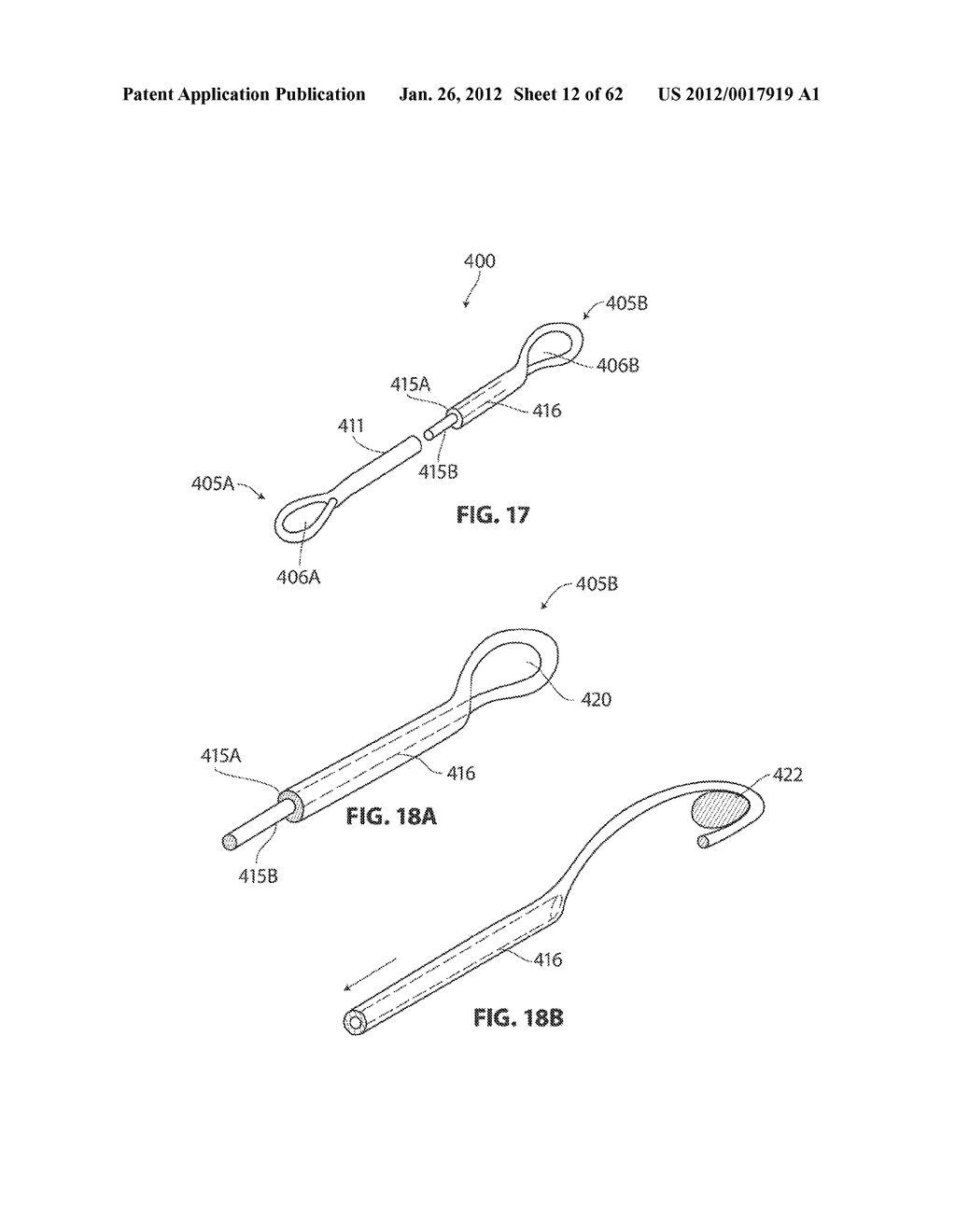 SYSTEMS AND METHODS FOR TREATMENT OF SLEEP APNEA - diagram, schematic, and image 13