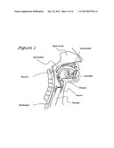 Method and Device for the Treatment of Obstructive Sleep Apnea and Snoring diagram and image