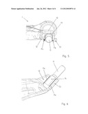 TRANSVERSE CONTROL ARM diagram and image