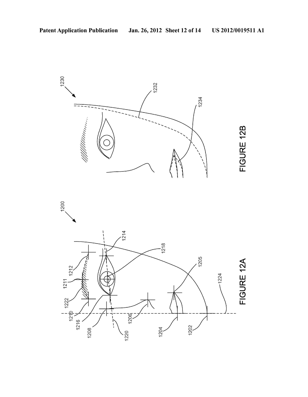 SYSTEM AND METHOD FOR REAL-TIME SURGERY VISUALIZATION - diagram, schematic, and image 13