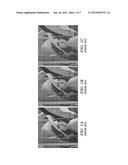 Efficient Motion-Adaptive Noise Reduction Scheme for Video Signals diagram and image