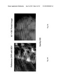 Intensity modulated arc therapy with continuous couch rotation/shift and     simultaneous cone beam imaging diagram and image