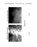 Intensity modulated arc therapy with continuous couch rotation/shift and     simultaneous cone beam imaging diagram and image