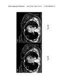 Intensity modulated arc therapy with continuous couch rotation/shift and     simultaneous cone beam imaging diagram and image