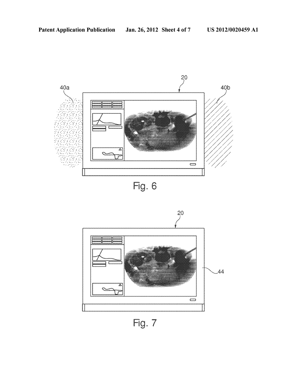 EXAMINATION APPARATUS - diagram, schematic, and image 05